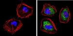 Cytokeratin Pan Antibody in Immunocytochemistry (ICC/IF)