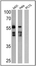 Cytokeratin Pan Antibody in Western Blot (WB)