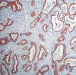 Cytokeratin 20 Antibody in Immunohistochemistry (Paraffin) (IHC (P))