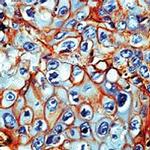 EGFR Antibody in Immunohistochemistry (Paraffin) (IHC (P))