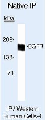 EGFR Antibody in Immunoprecipitation (IP)