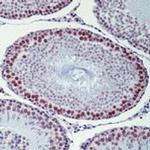 XRCC1 Antibody in Immunohistochemistry (Paraffin) (IHC (P))