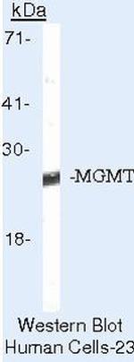 MGMT Antibody in Western Blot (WB)