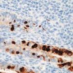 Adenovirus Type 2 E1A Antibody in Immunohistochemistry (Paraffin) (IHC (P))