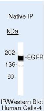 EGFR Antibody in Immunoprecipitation (IP)