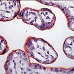 INSR alpha Antibody in Immunohistochemistry (IHC)