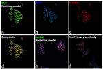 INSR Antibody in Immunocytochemistry (ICC/IF)