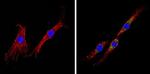 INSR Antibody in Immunocytochemistry (ICC/IF)