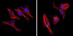 INSR Antibody in Immunocytochemistry (ICC/IF)