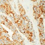 MVP Antibody in Immunohistochemistry (Paraffin) (IHC (P))