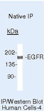 EGFR Antibody in Immunoprecipitation (IP)