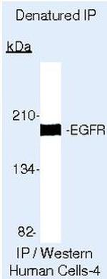 EGFR Antibody in Immunoprecipitation (IP)