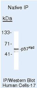 p57 Kip2 Antibody in Immunoprecipitation (IP)