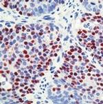 p57 Kip2 Antibody in Immunohistochemistry (Paraffin) (IHC (P))