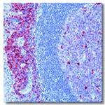 CD38 Antibody in Immunohistochemistry (Paraffin) (IHC (P))