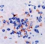 Kappa/Lambda Antibody in Immunohistochemistry (Paraffin) (IHC (P))