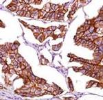 beta Catenin Antibody in Immunohistochemistry (Paraffin) (IHC (P))