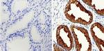 PSA Antibody in Immunohistochemistry (Paraffin) (IHC (P))