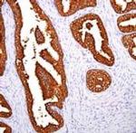 PSA Antibody in Immunohistochemistry (Paraffin) (IHC (P))