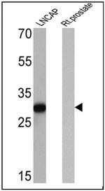 PSA Antibody in Western Blot (WB)