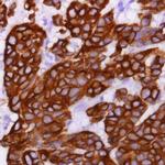 Cytokeratin 8 Antibody in Immunohistochemistry (Paraffin) (IHC (P))