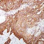 Phospho-EGFR (Tyr1068) Antibody in Immunohistochemistry (Paraffin) (IHC (P))