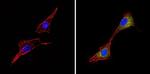 ALK Antibody in Immunocytochemistry (ICC/IF)