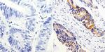 COX2 Antibody in Immunohistochemistry (Paraffin) (IHC (P))