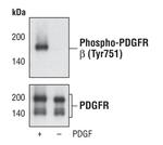 Phospho-PDGFRB (Tyr751) Antibody in Western Blot (WB)