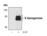 ALOX5 Antibody in Western Blot (WB)