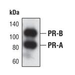 Progesterone Receptor Antibody in Western Blot (WB)