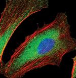 SHIP2 Antibody in Immunocytochemistry (ICC/IF)