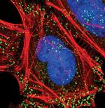 NUMB Antibody in Immunocytochemistry (ICC/IF)