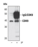 CDK9 Antibody in Immunoprecipitation (IP)