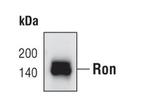 RON Antibody in Western Blot (WB)