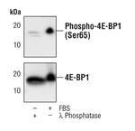 Phospho-4EBP1 (Ser65) Antibody in Western Blot (WB)