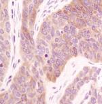 Acetyl-CoA Carboxylase Antibody in Immunohistochemistry (Paraffin) (IHC (P))