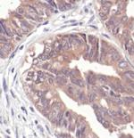 NQO1 Antibody in Immunohistochemistry (Paraffin) (IHC (P))