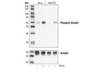 Phospho-SMAD2 (Ser465, Ser467) Antibody in Western Blot (WB)