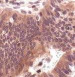 MEK1/MEK2 Antibody in Immunohistochemistry (Paraffin) (IHC (P))