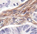 PDGFRB Antibody in Immunohistochemistry (Paraffin) (IHC (P))