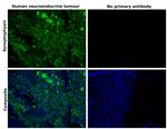 Synaptophysin Antibody in Immunohistochemistry (Paraffin) (IHC (P))