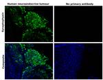 Synaptophysin Antibody in Immunohistochemistry (Paraffin) (IHC (P))