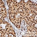 TERT Antibody in Immunohistochemistry (Paraffin) (IHC (P))