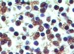 Dectin 2 Antibody in Immunohistochemistry (Paraffin) (IHC (P))