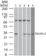 Dectin 2 Antibody in Western Blot (WB)