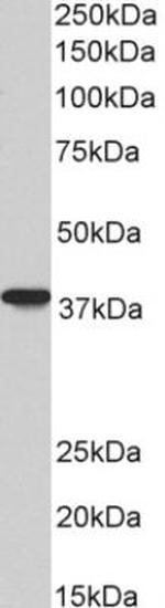 AIM2 Antibody in Western Blot (WB)