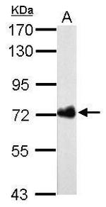 Helicobacter pylori Urease B Antibody in Western Blot (WB)