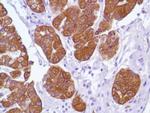 Cytokeratin 18 Antibody in Immunohistochemistry (Paraffin) (IHC (P))