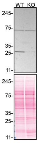 RhoGDI Antibody